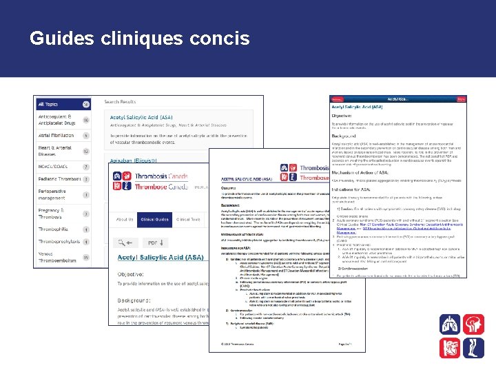 Guides cliniques concis 