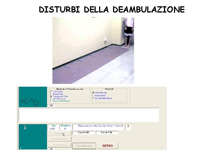 DISTURBI DELLA DEAMBULAZIONE 