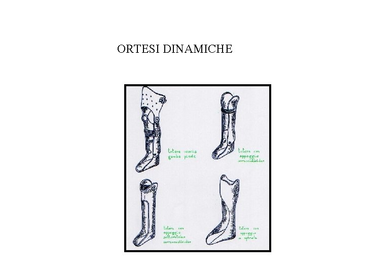 ORTESI DINAMICHE 