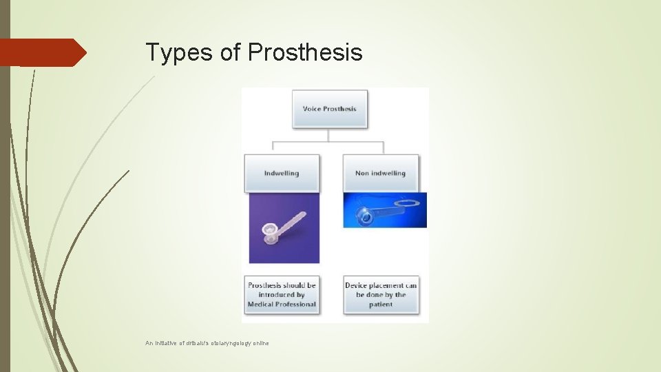 Types of Prosthesis An initiative of drtbalu's otolaryngology online 