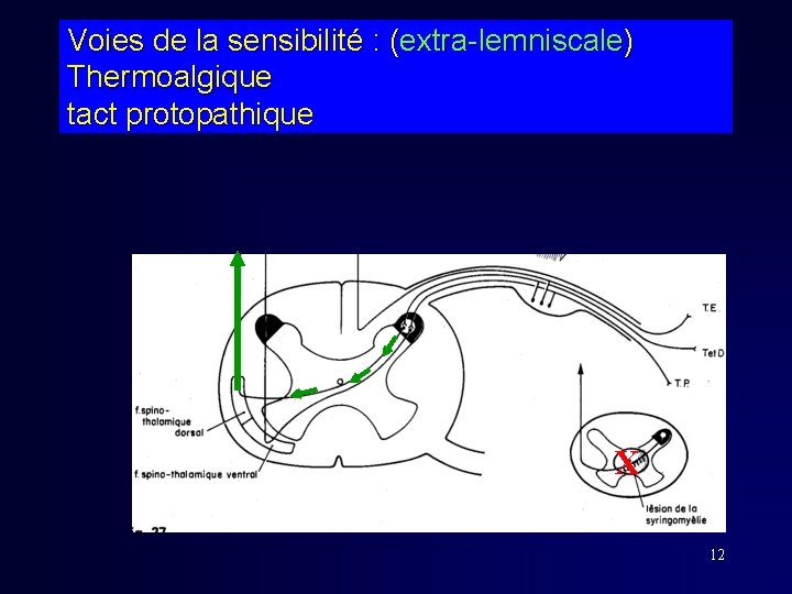 Voies de la sensibilité : (extra-lemniscale) Thermoalgique tact protopathique X 12 