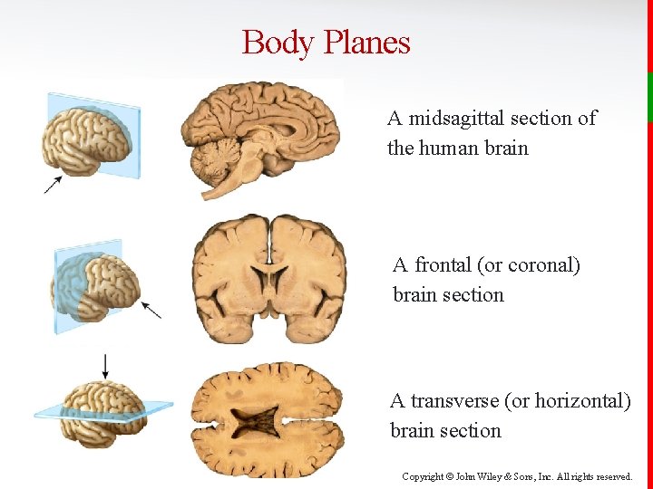 Body Planes A midsagittal section of the human brain A frontal (or coronal) brain