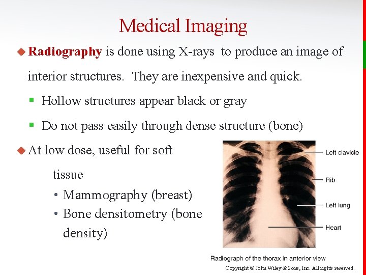 Medical Imaging u Radiography is done using X-rays to produce an image of interior
