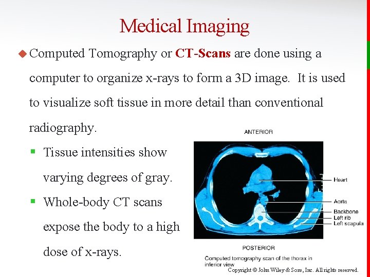 Medical Imaging u Computed Tomography or CT-Scans are done using a computer to organize