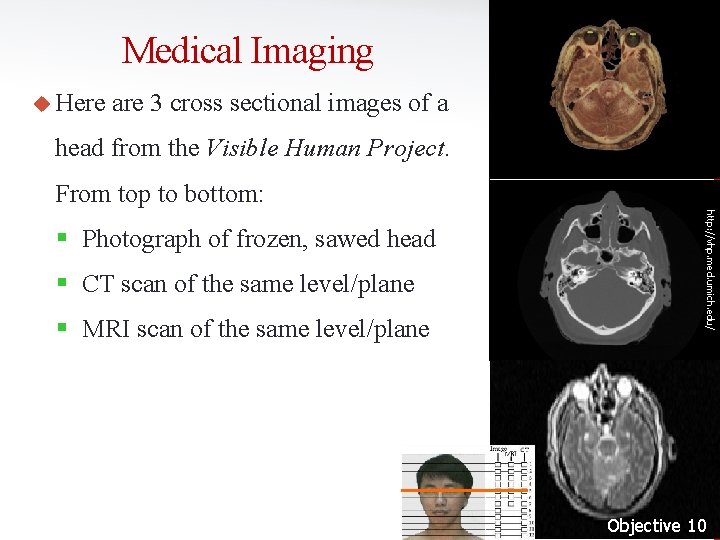 Medical Imaging u Here are 3 cross sectional images of a head from the