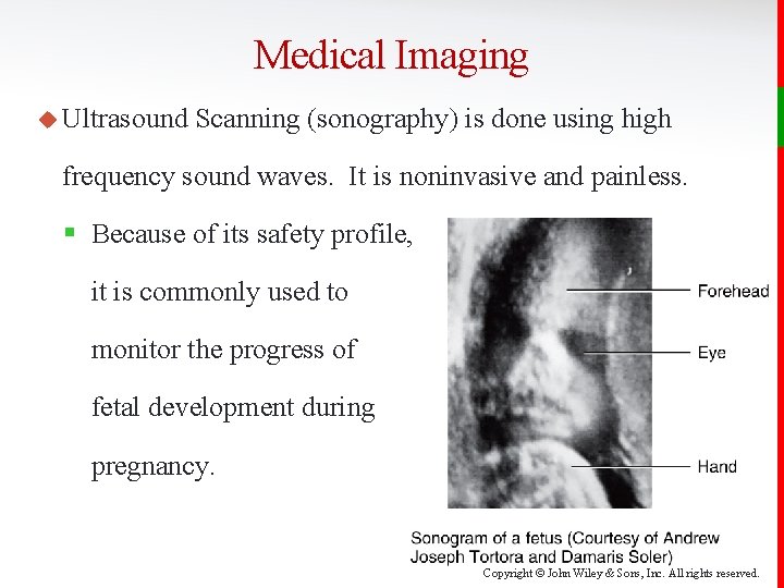 Medical Imaging u Ultrasound Scanning (sonography) is done using high frequency sound waves. It
