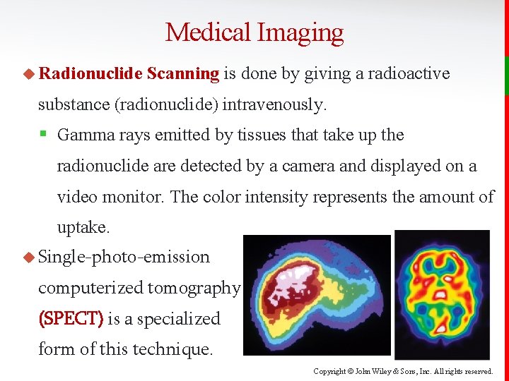 Medical Imaging u Radionuclide Scanning is done by giving a radioactive substance (radionuclide) intravenously.