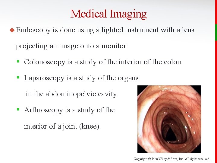 Medical Imaging u Endoscopy is done using a lighted instrument with a lens projecting