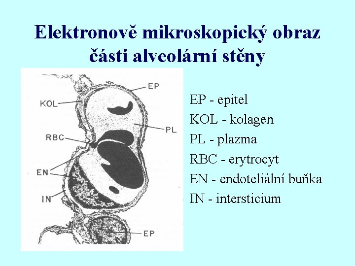 Elektronově mikroskopický obraz části alveolární stěny EP - epitel KOL - kolagen PL -