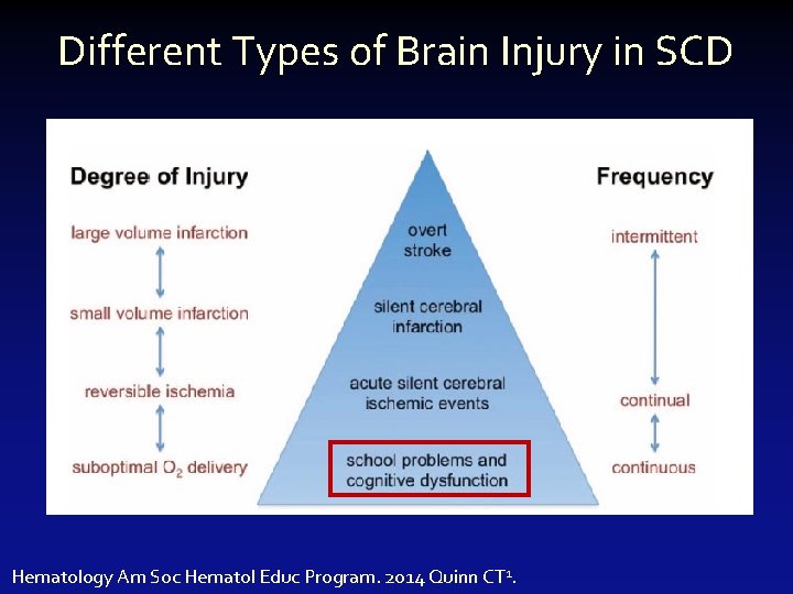 Different Types of Brain Injury in SCD Hematology Am Soc Hematol Educ Program. 2014