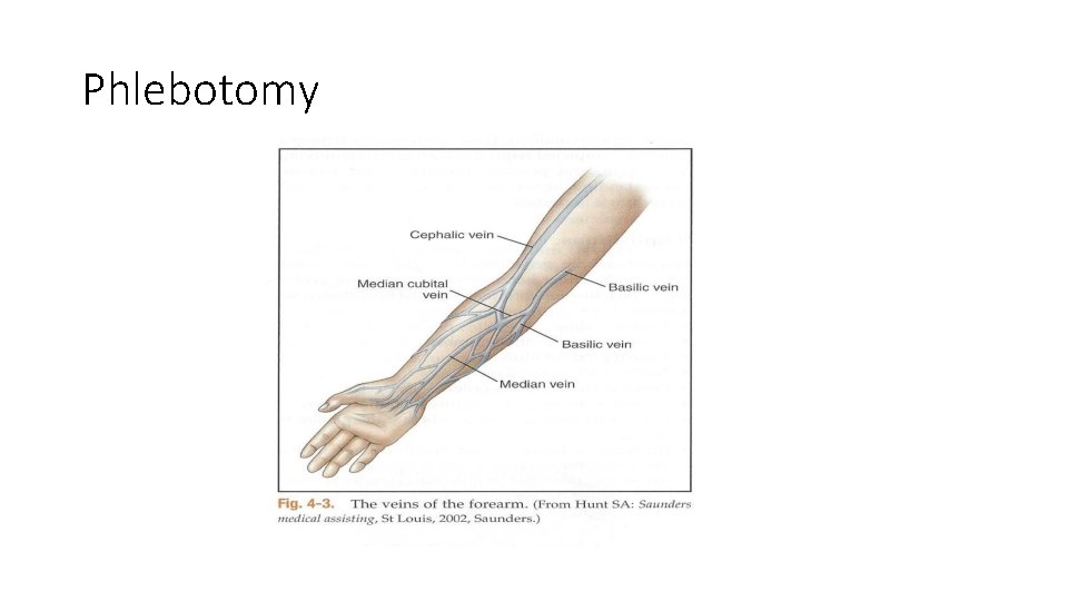 Phlebotomy 