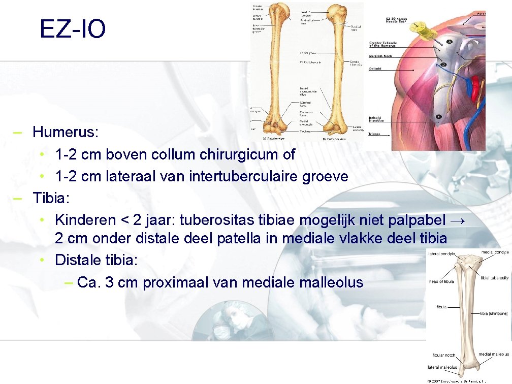 EZ-IO – Humerus: • 1 -2 cm boven collum chirurgicum of • 1 -2