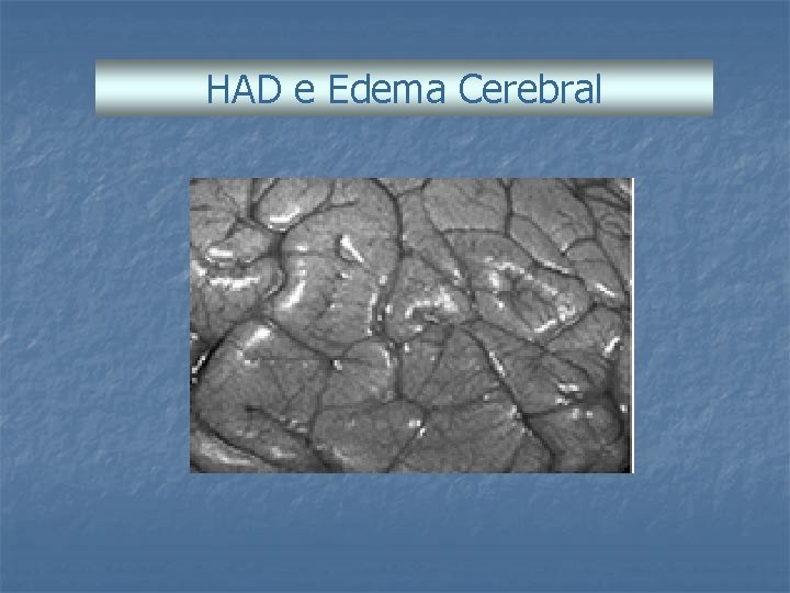 HAD e Edema Cerebral 