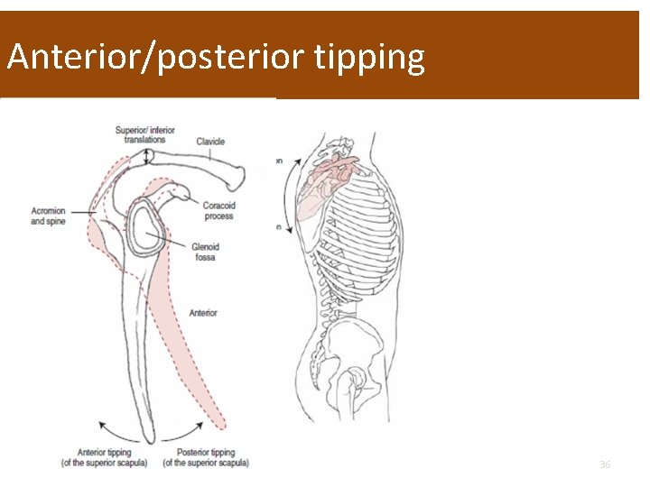 Anterior/posterior tipping 36 
