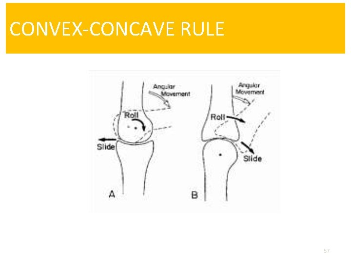 CONVEX-CONCAVE RULE 57 