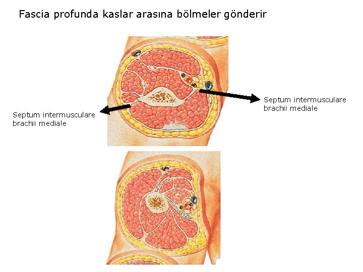 Fascia profunda kaslar arasına bölmeler gönderir Septum intermusculare brachii mediale 