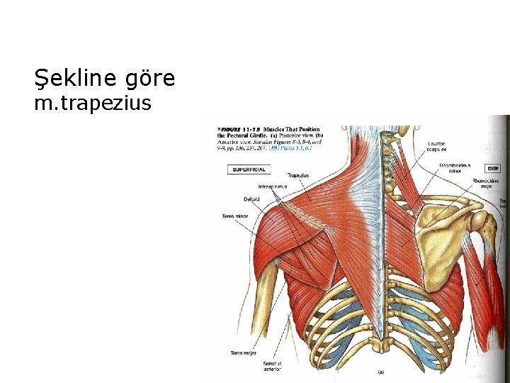 Şekline göre m. trapezius 