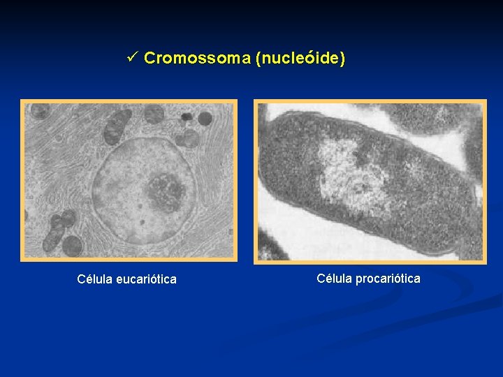 ü Cromossoma (nucleóide) Célula eucariótica Célula procariótica 