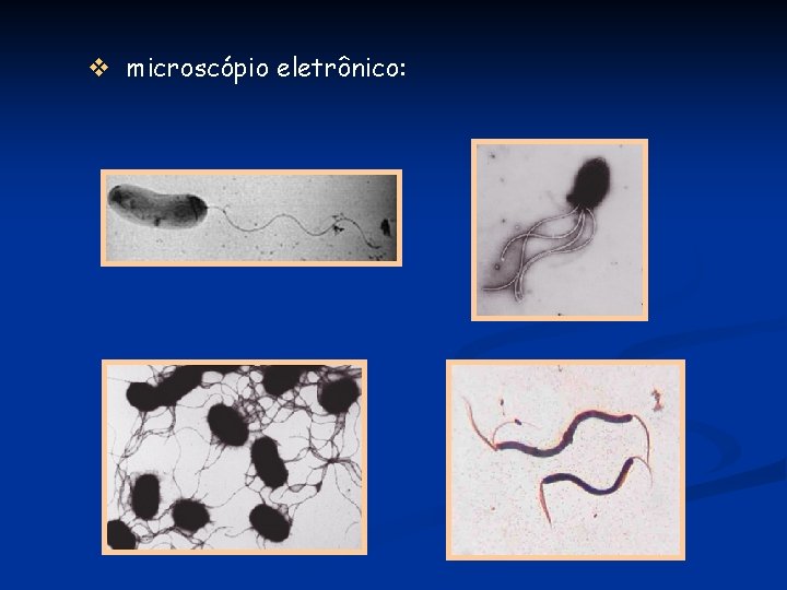 v microscópio eletrônico: 