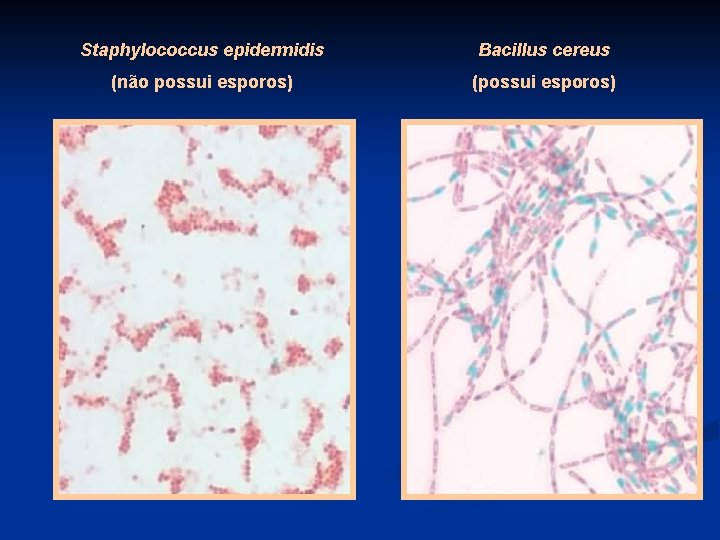 Staphylococcus epidermidis Bacillus cereus (não possui esporos) (possui esporos) 