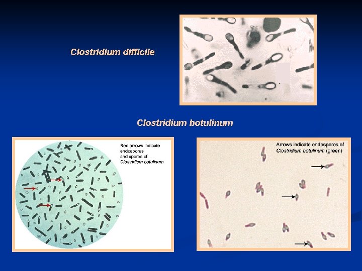 Clostridium difficile Clostridium botulinum 