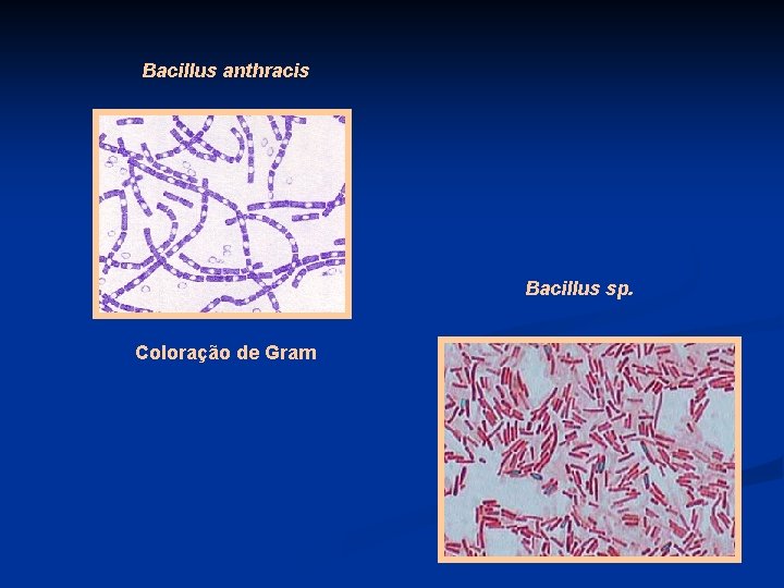 Bacillus anthracis Bacillus sp. Coloração de Gram 