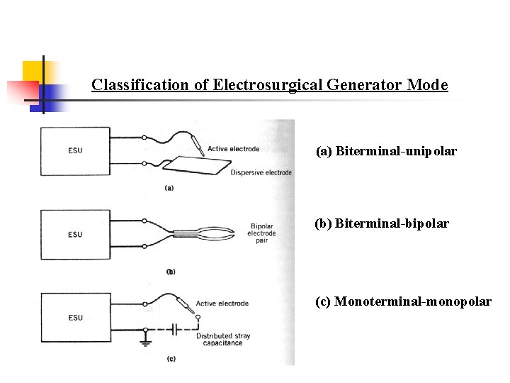 Classification of Electrosurgical Generator Mode (a) Biterminal-unipolar (b) Biterminal-bipolar (c) Monoterminal-monopolar 