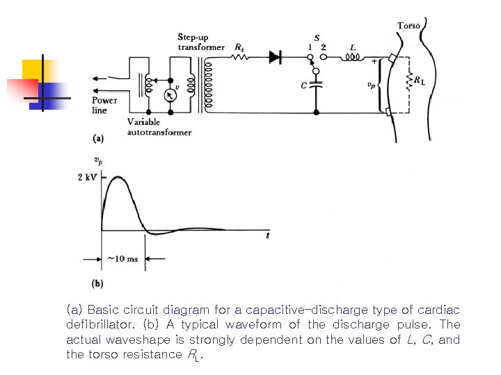 (a) Basic circuit diagram for a capacitive–discharge type of cardiac defibrillator. (b) A typical