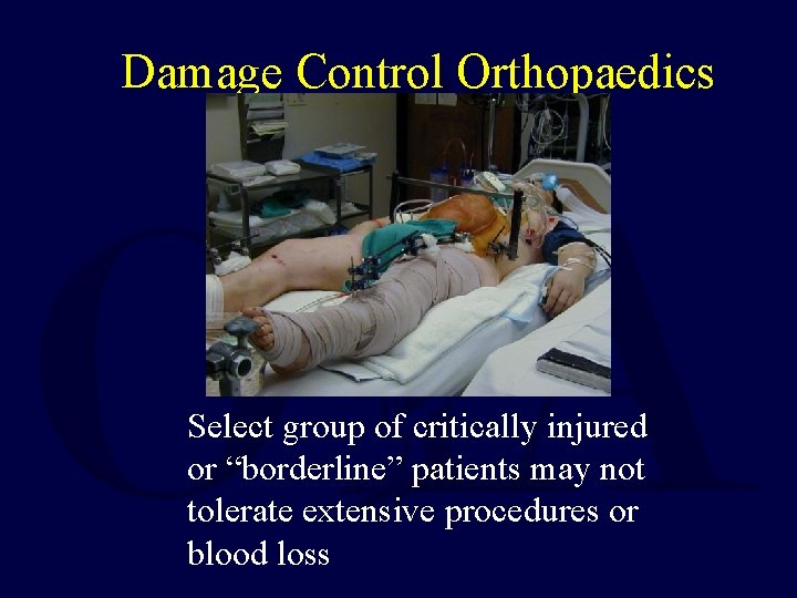 Damage Control Orthopaedics Select group of critically injured or “borderline” patients may not tolerate