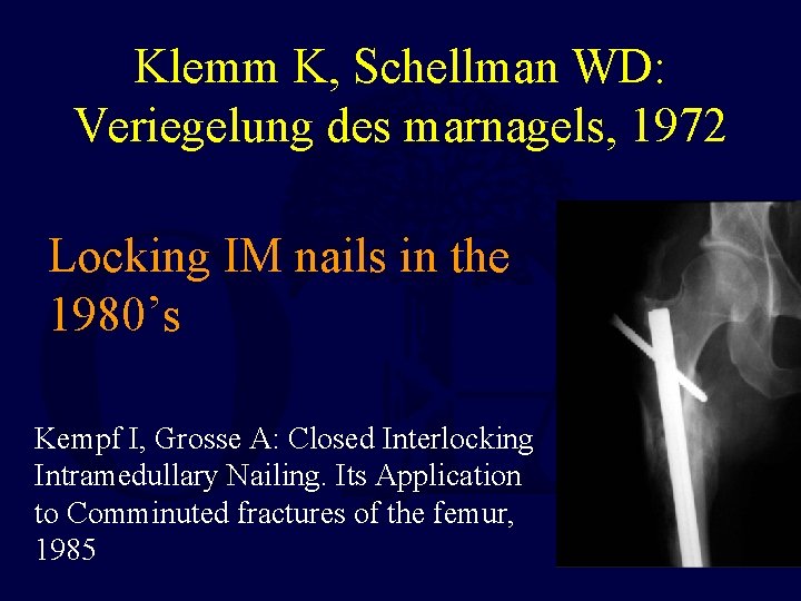 Klemm K, Schellman WD: Veriegelung des marnagels, 1972 Locking IM nails in the 1980’s