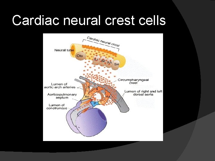 Cardiac neural crest cells 