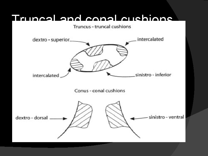 Truncal and conal cushions 