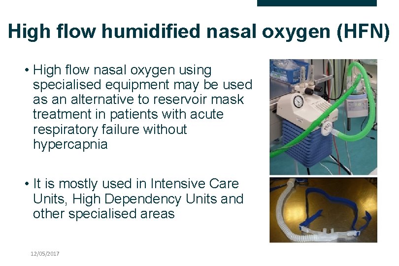 High flow humidified nasal oxygen (HFN) • High flow nasal oxygen using specialised equipment