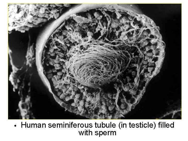  • Human seminiferous tubule (in testicle) filled with sperm 