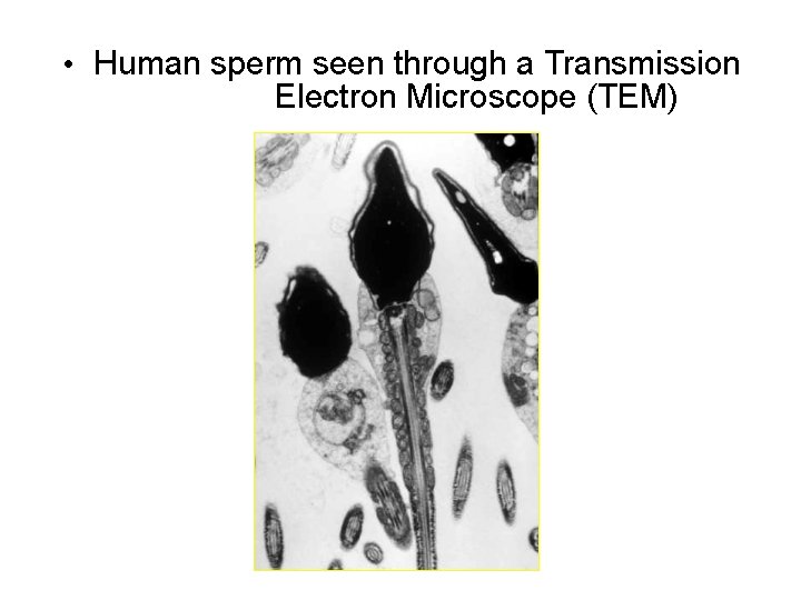  • Human sperm seen through a Transmission Electron Microscope (TEM) 