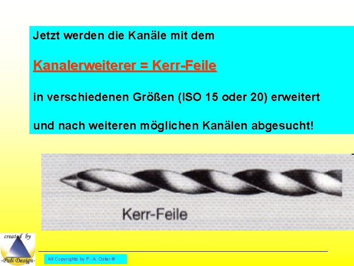 Jetzt werden die Kanäle mit dem Kanalerweiterer = Kerr-Feile in verschiedenen Größen (ISO 15