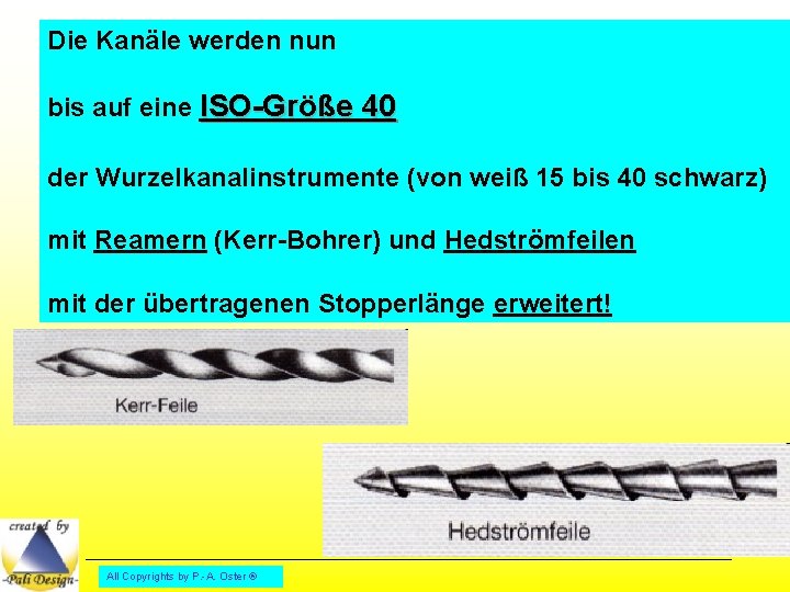 Die Kanäle werden nun bis auf eine ISO-Größe 40 der Wurzelkanalinstrumente (von weiß 15