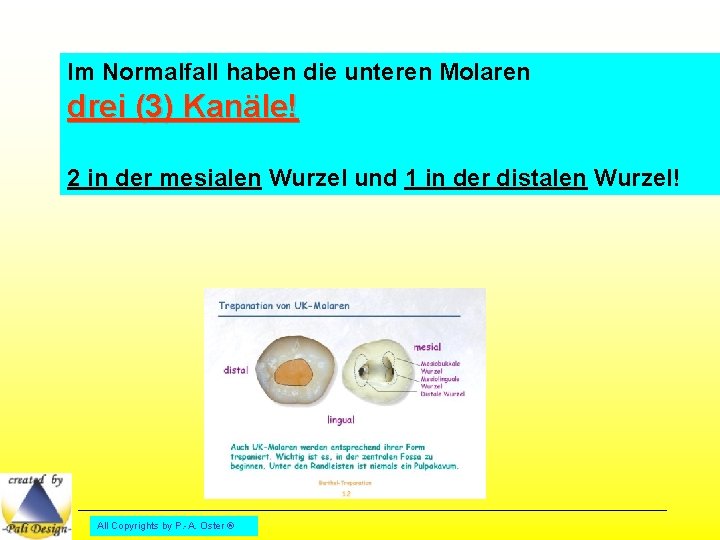 Im Normalfall haben die unteren Molaren drei (3) Kanäle! 2 in der mesialen Wurzel