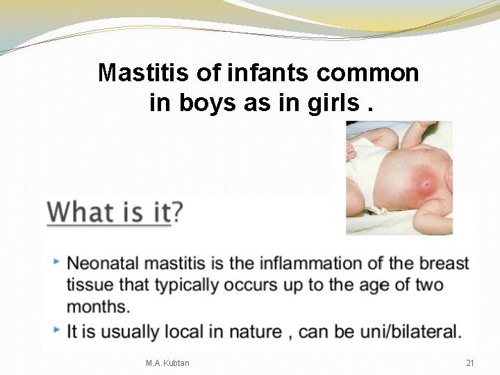 Mastitis of infants common in boys as in girls. M. A. Kubtan 21 