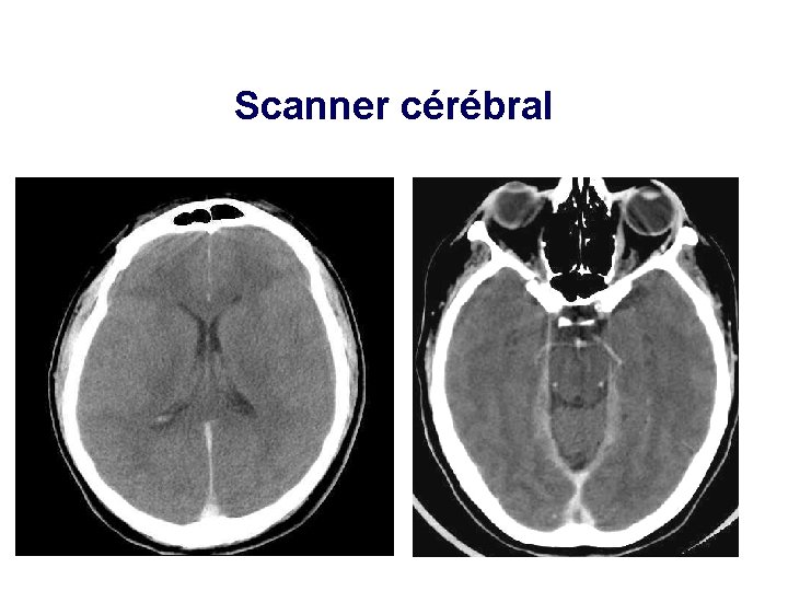 Scanner cérébral 21 