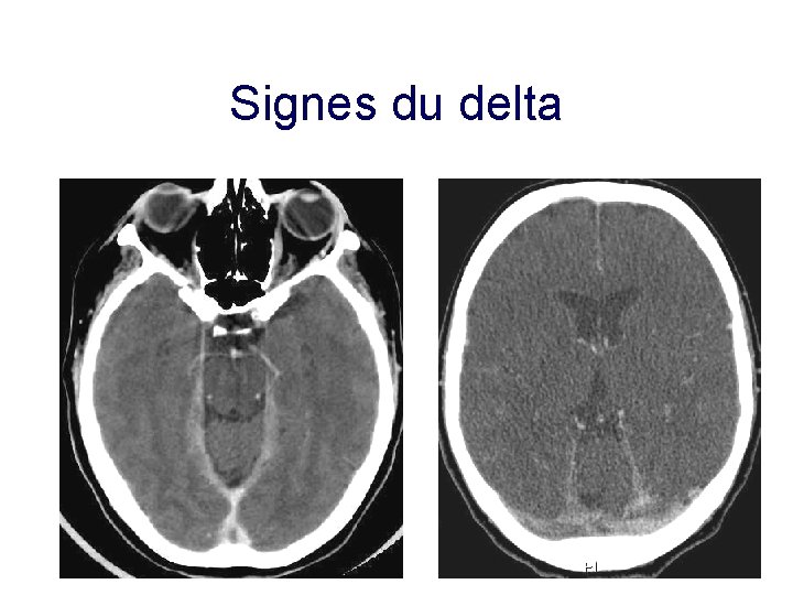 Signes du delta 27 