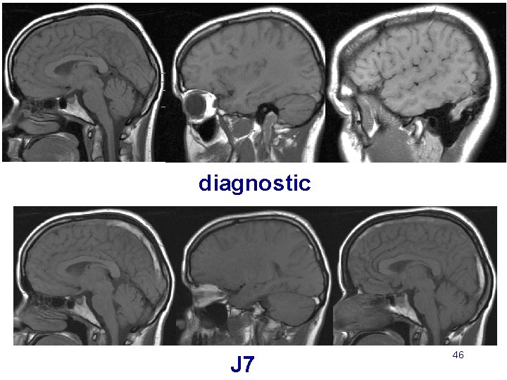 diagnostic J 7 46 
