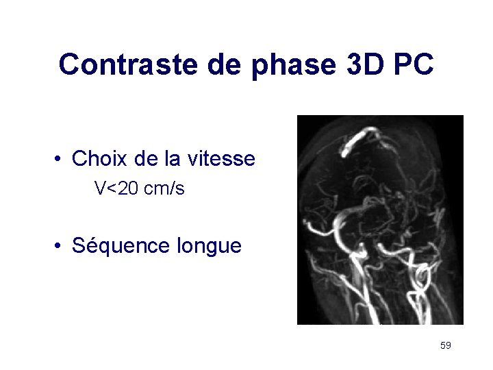 Contraste de phase 3 D PC • Choix de la vitesse V<20 cm/s •