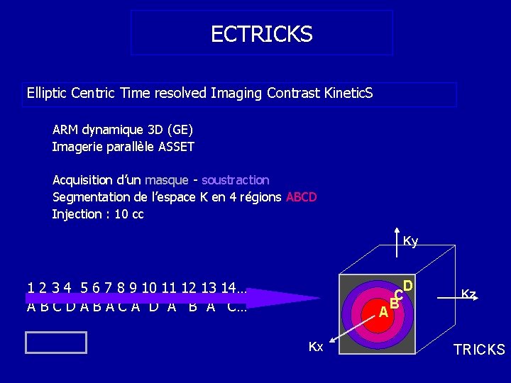ECTRICKS Elliptic Centric Time resolved Imaging Contrast Kinetic. S ARM dynamique 3 D (GE)
