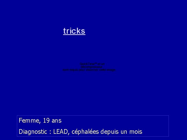 tricks Femme, 19 ans Diagnostic : LEAD, céphalées depuis un mois 66 