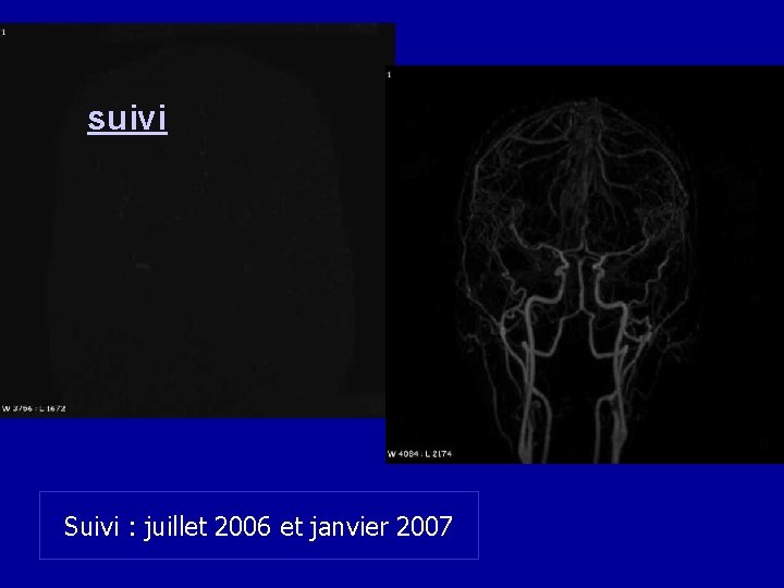 suivi Suivi : juillet 2006 et janvier 2007 68 