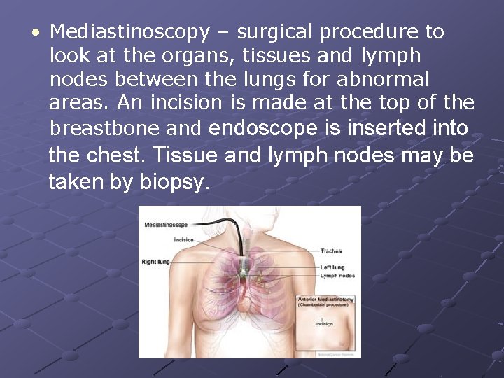  • Mediastinoscopy – surgical procedure to look at the organs, tissues and lymph