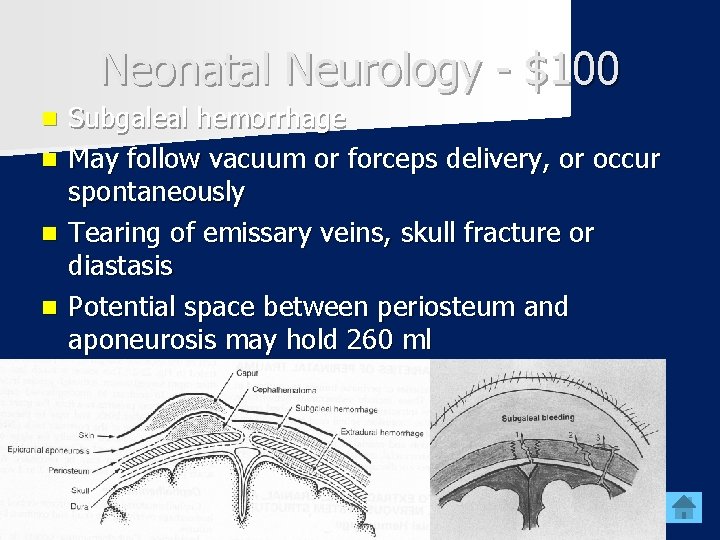 Neonatal Neurology - $100 n n Subgaleal hemorrhage May follow vacuum or forceps delivery,