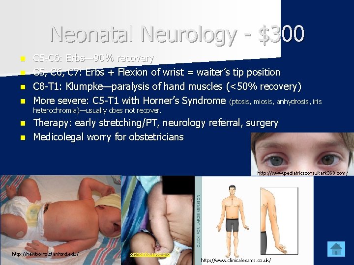 Neonatal Neurology - $300 n n C 5 -C 6: Erbs— 90% recovery C