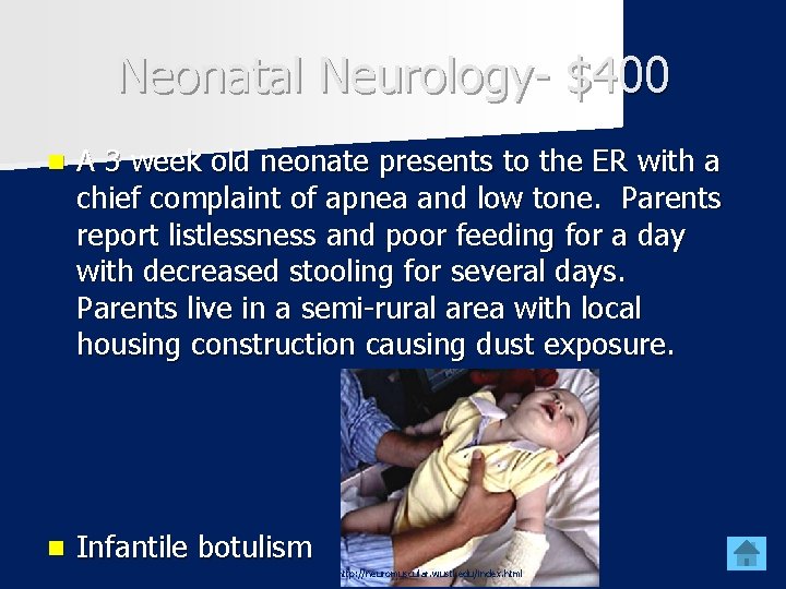 Neonatal Neurology- $400 n A 3 week old neonate presents to the ER with